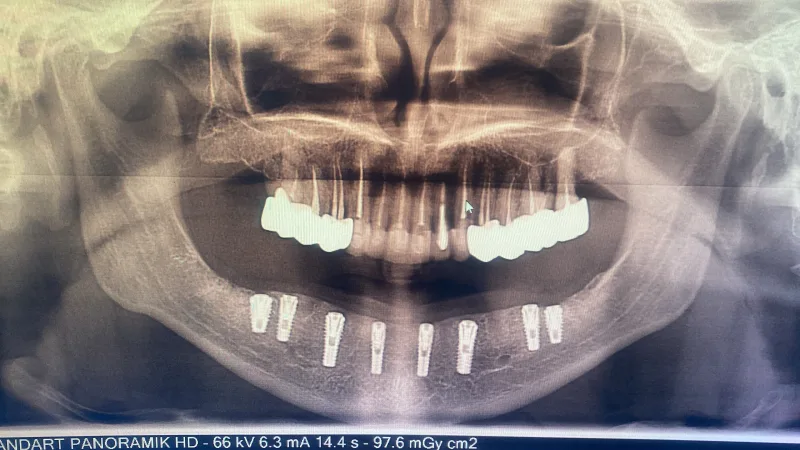 Alanya HEALTHY TEETH Dental Aesthetic — Medicina em Alanya: Encomenda online, preços e comentários